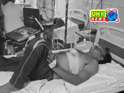 झांसी : सड़क पर गुटखा थूकने पर युवक को मारी गोली