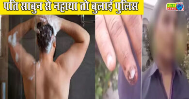 Aligarh: When husband bathed with wife's soap, police was called, showing broken nails the husband said - hit me with a brick