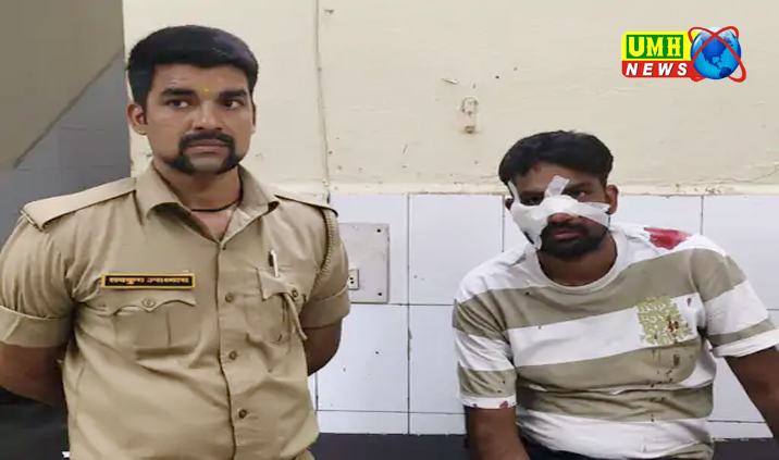 अलीगढ़ : चाइनीज मांझे से कटा टीचर का चेहरा