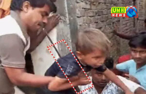 A bar passed through a child's stomach in UP