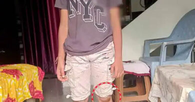 गोरखपुर  : टीचर ने बच्चे को पटक-पटक कर पीटा, दांत टूटा