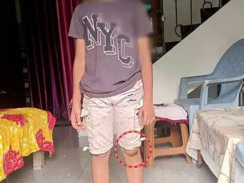 गोरखपुर  : टीचर ने बच्चे को पटक-पटक कर पीटा, दांत टूटा