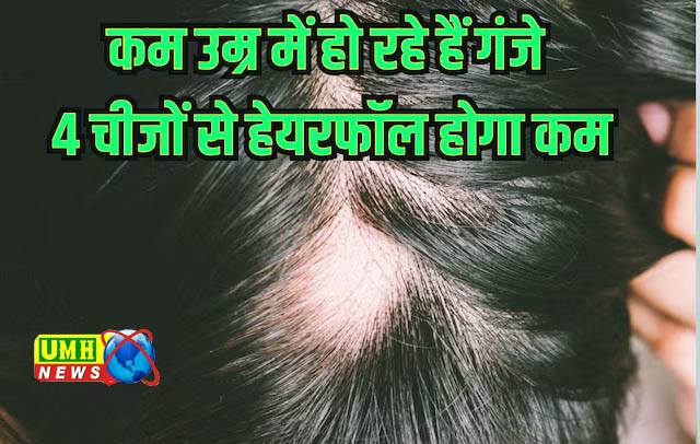 हेयरफॉल को इन 4 नेचुरल चीजों से करें कंट्रोल, दोबारा उगने लगेंगे बाल