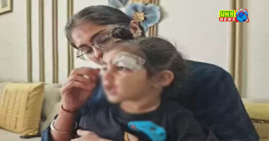 मेरठ : फेवीक्विक से जोड़ा ढाई साल के बच्चे का घाव