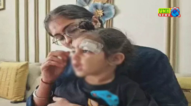 मेरठ : फेवीक्विक से जोड़ा ढाई साल के बच्चे का घाव