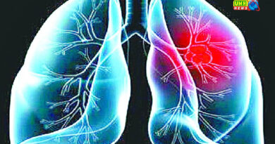 काम के काॅन्टेक्ट को कम करने के आसान उपाये : डाॅ हरेन्द्र चौधरी 