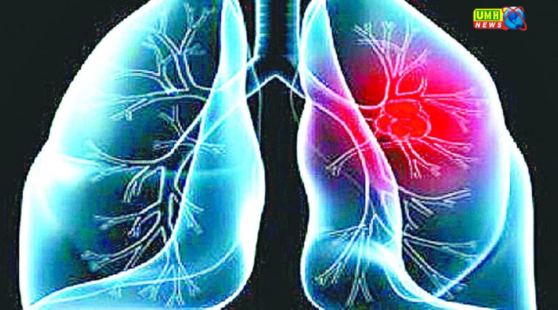 काम के काॅन्टेक्ट को कम करने के आसान उपाये : डाॅ हरेन्द्र चौधरी 